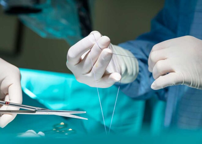 Stitches vs Sutures: A Guide
